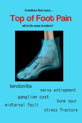 TOP OF FOOT PAIN Causes, Diagnosis, Treatment, Prevention