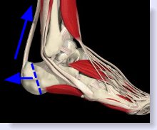 calcaneal apophysitis