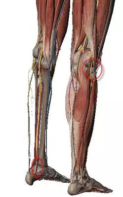 nerve entrapments causing foot pain