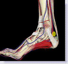 bursitis on foot