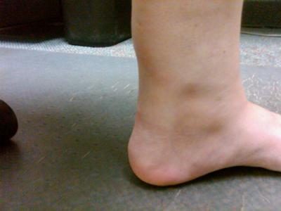 inner left ankle