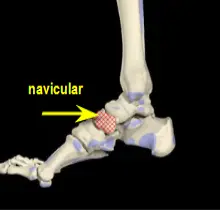 navicular bone