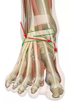 area of pain one month after trauma