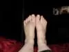 bot my feet side by side after 5 days