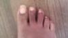 toe nails are not attached