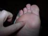 sharp pain on bottom of foot